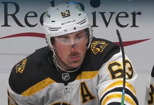 Such a difference in Sports. Marchand on the bench after 2 goals and an assist since getting his nose busted up with a high stick. In Baseball he would be out 4-6 weeks.