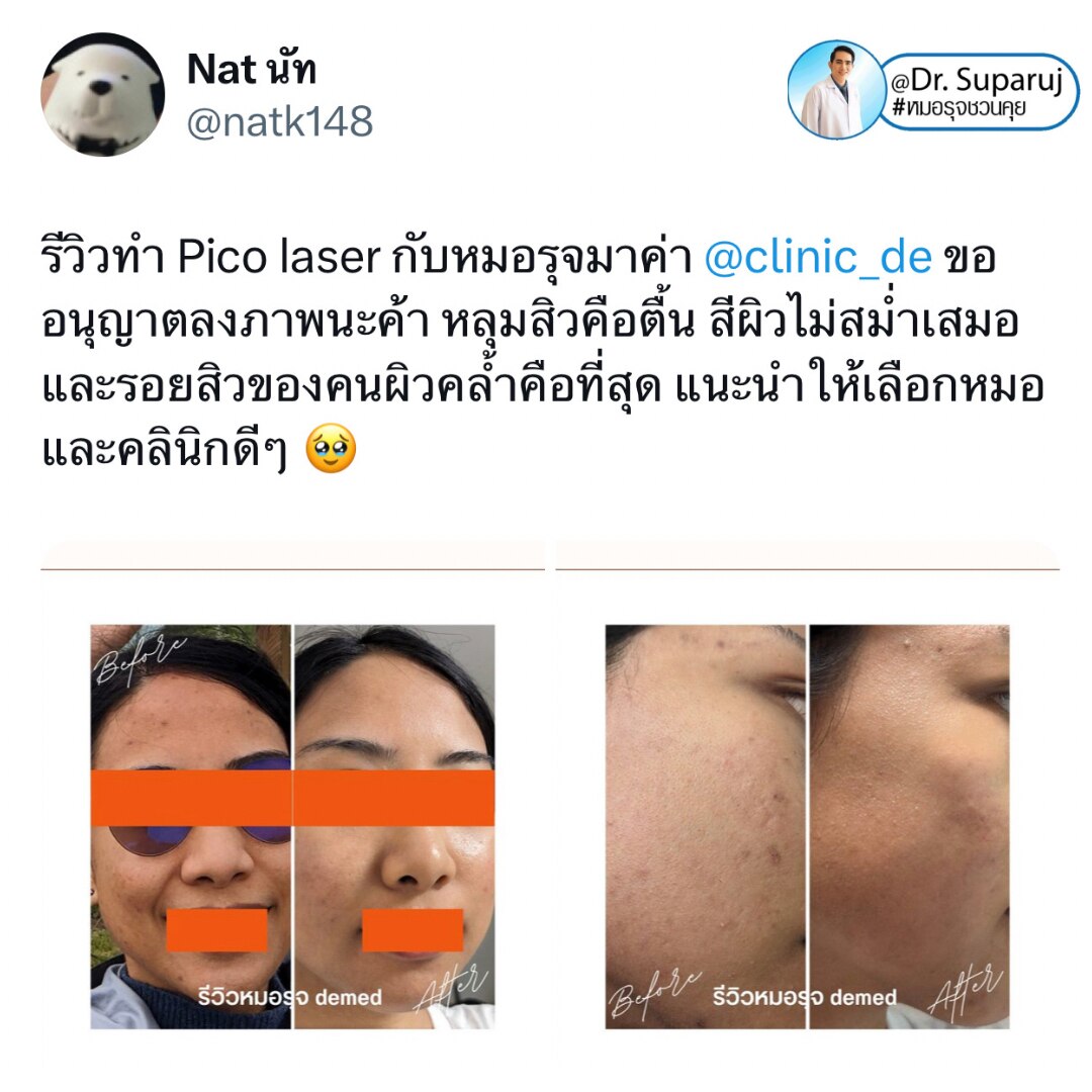 🔬Your support and trust in us are much cherished. Every acne scar is different. In fact, every scar...