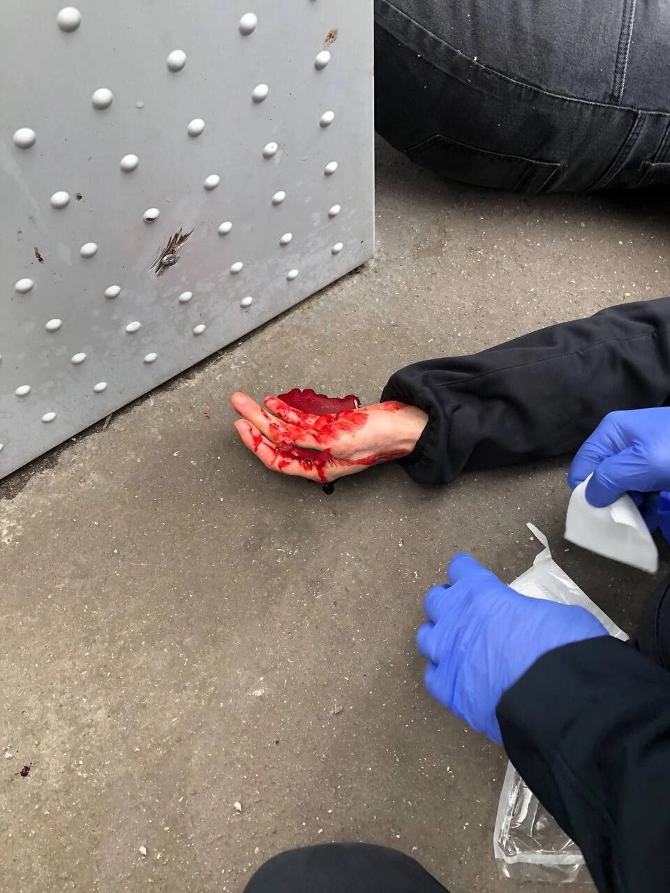 23/03/2023 ROUEN
Une enseignante qui manifestait contre la réforme des retraites a eu son pouce arra...