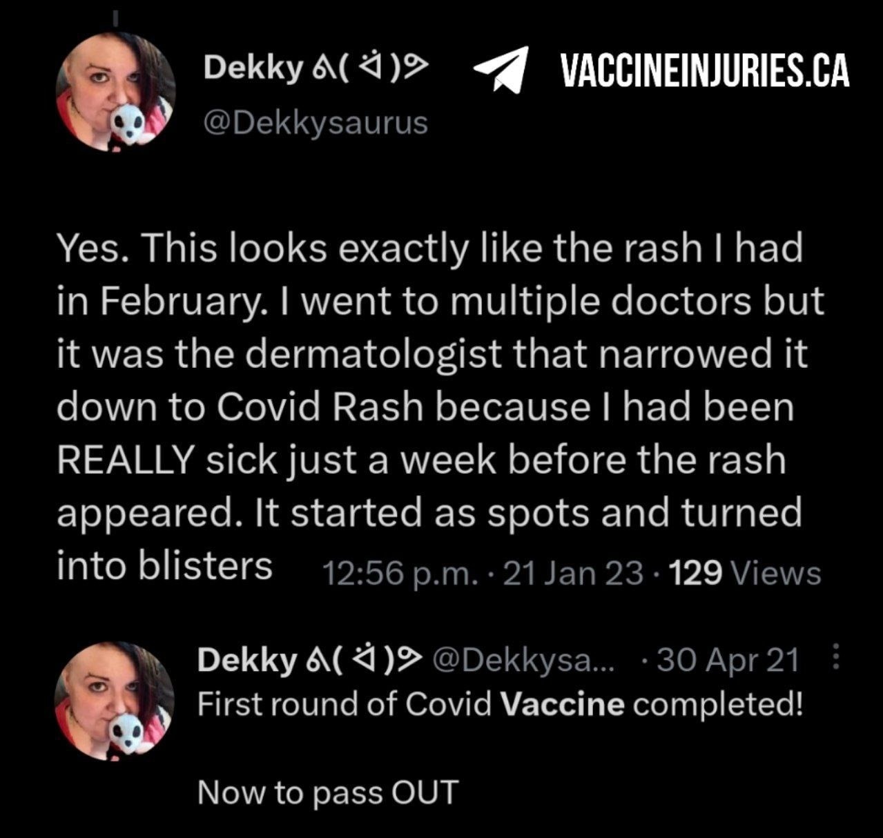 Covid-19 Vaccine Rash 💉😳😵‍💫