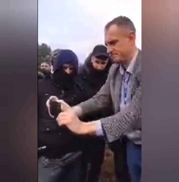 Migrants put cigarette smoke into kid eyes and then record "interview" for CNN, MSNBC and BBC claimi...