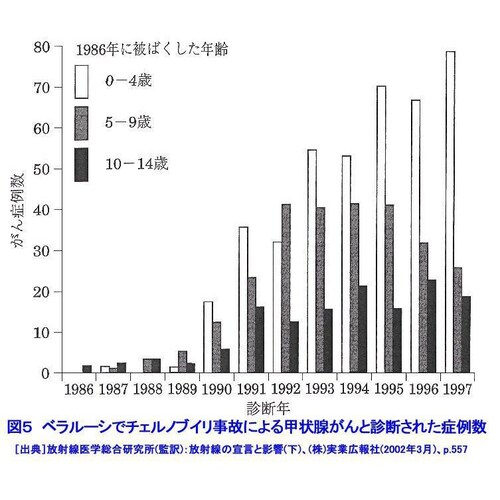 放射能内部被爆と発ガン

世界一被爆している日本、この結果どのようなことが起こるか、まだ人々は把握していないようである。

アメリカの予防医療作業部会は40代の定期検診にマンモグラフィーを勧めていない...