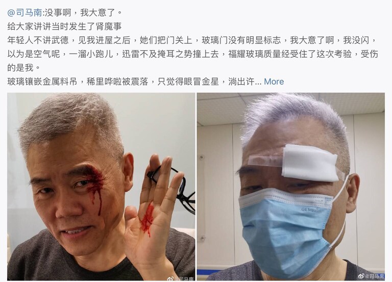 一人游北京,在南锣鼓巷突然内急想上大号。遇到司马南,向他问路。司马南装作聋哑先指指嘴再摇摇头,接着用手指做数钱状,明示红包,方肯引路。游人知其意,即赛给他张红票子,司马南才开口说:“快随我去我家,南锣鼓巷8号。”游人问:“为什么不给钱就装哑巴?”回答道:“我司马南只为了钱说话!你快快去我家拉屎吧!”
(注:司