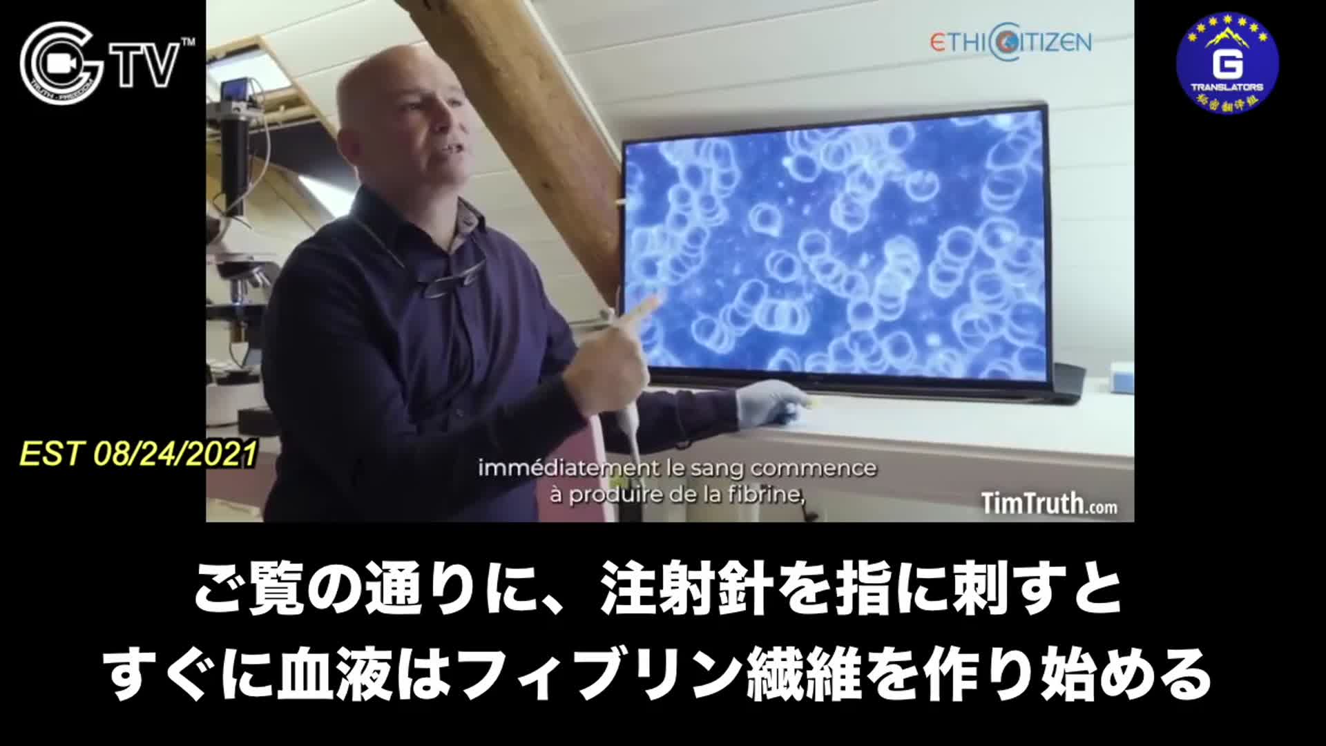 8/24/2021 [JP]
医学研究は、ワクチン接種後、血液細胞が留められ、繊維化し、血栓が出来ることを明らかになった.