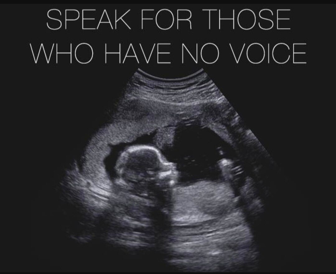 View kajunwax's post on GETTR. Join the discussion, share your thoughts, and connect with the community.