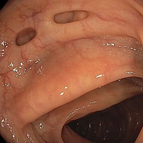 I am pro-vaccines, but anti mandates. It's a personal choice. Joe biden is the only one to blame. People won’t believe y...