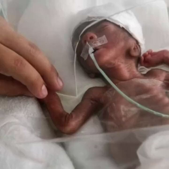 Dr Fauci sewing baby parts onto humanized rats. #arrestfauci  

