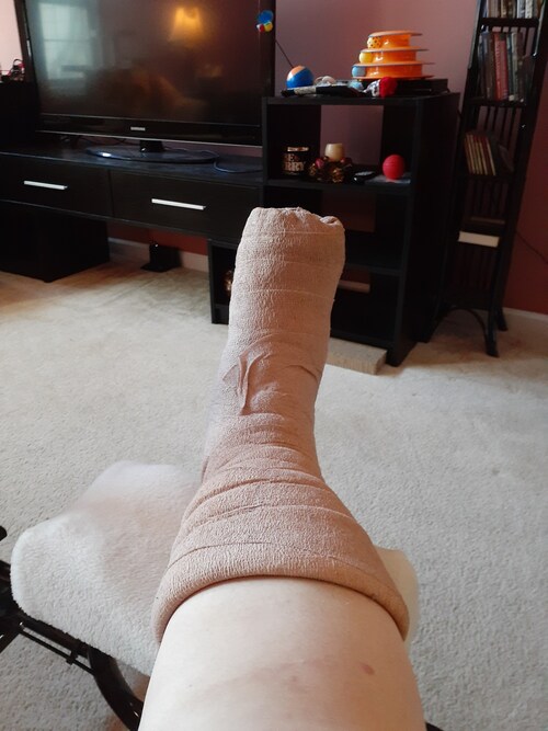 I am convinced the creator of #uggboots found themselves in a soft cast and said "I bet people would pay $$ if I made these into boots.".

#Entrepreneur  #ingenuity