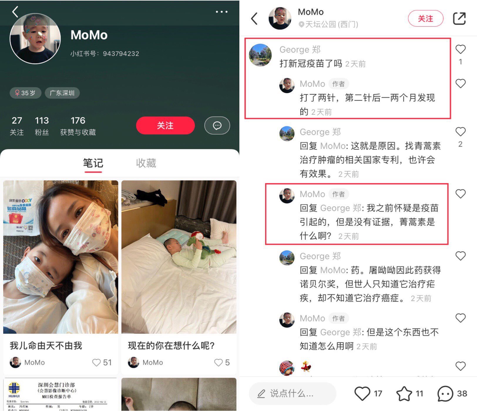 💔“妈妈，我不想死…”深圳冯哲旭，7岁健康男孩，打新冠疫苗后确诊恶性脑瘤，治疗一个月后，被告知孩子没救了。妈妈说：“真的没救了吗？我的宝贝才7岁，如果我有罪，请老天爷惩罚我，别惩罚我的儿子……打了两...