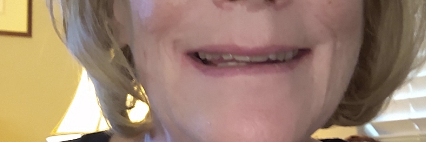 goldyopal