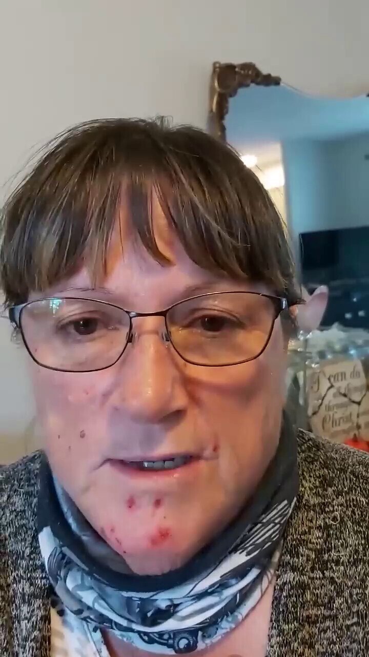 🇨🇦 Tumbler Ridge, 加拿大。接受Covid疫苗后出现可怕的脸部溃疡--"我希望我从未注射过这种疫苗"。💉🇨🇦 Tumbler Ridge BC, Canada: Horrib...