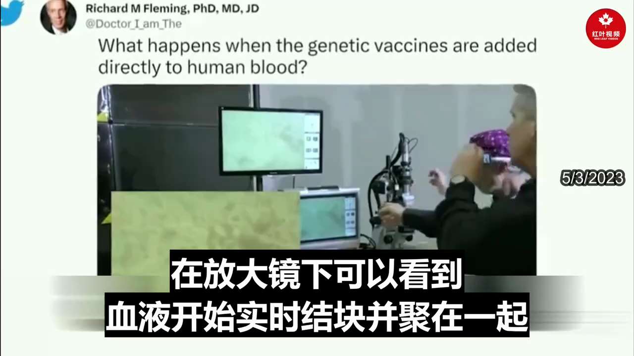 🛟WATCH: Thermographic Imaging Shows Massive Blood Clots in the Asymptomatic Vaxxed.
热成像显示无症状疫苗接种者有大...