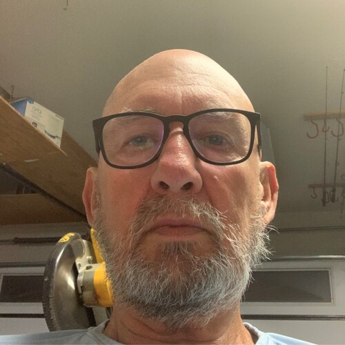 Born 1949 in Coventry, England. US Citizen living in Socialist California. Search Thalidomide baby pictures 60 years ago...