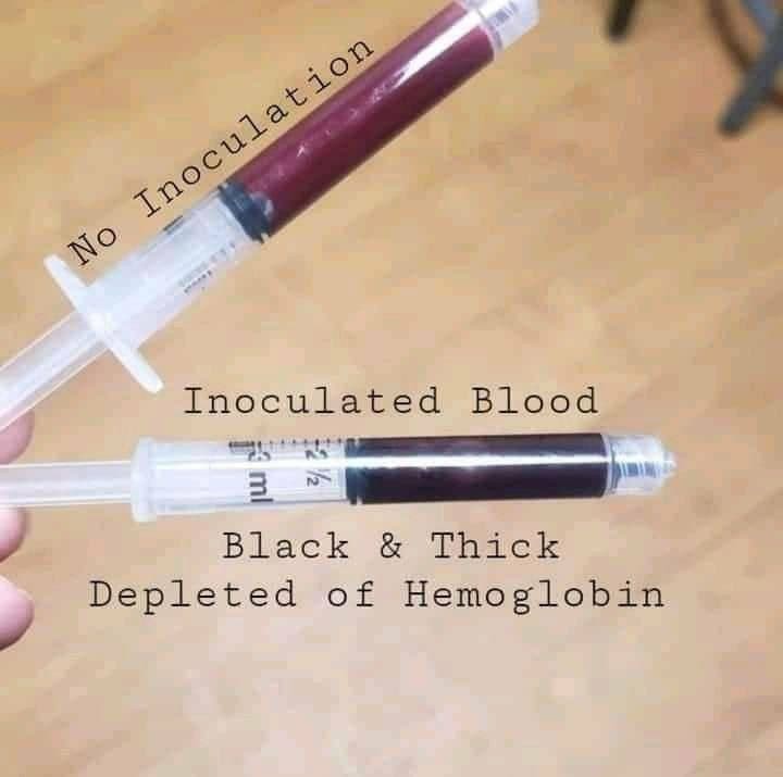 Vaxxed vs. Un vaxxed BLOOD. 