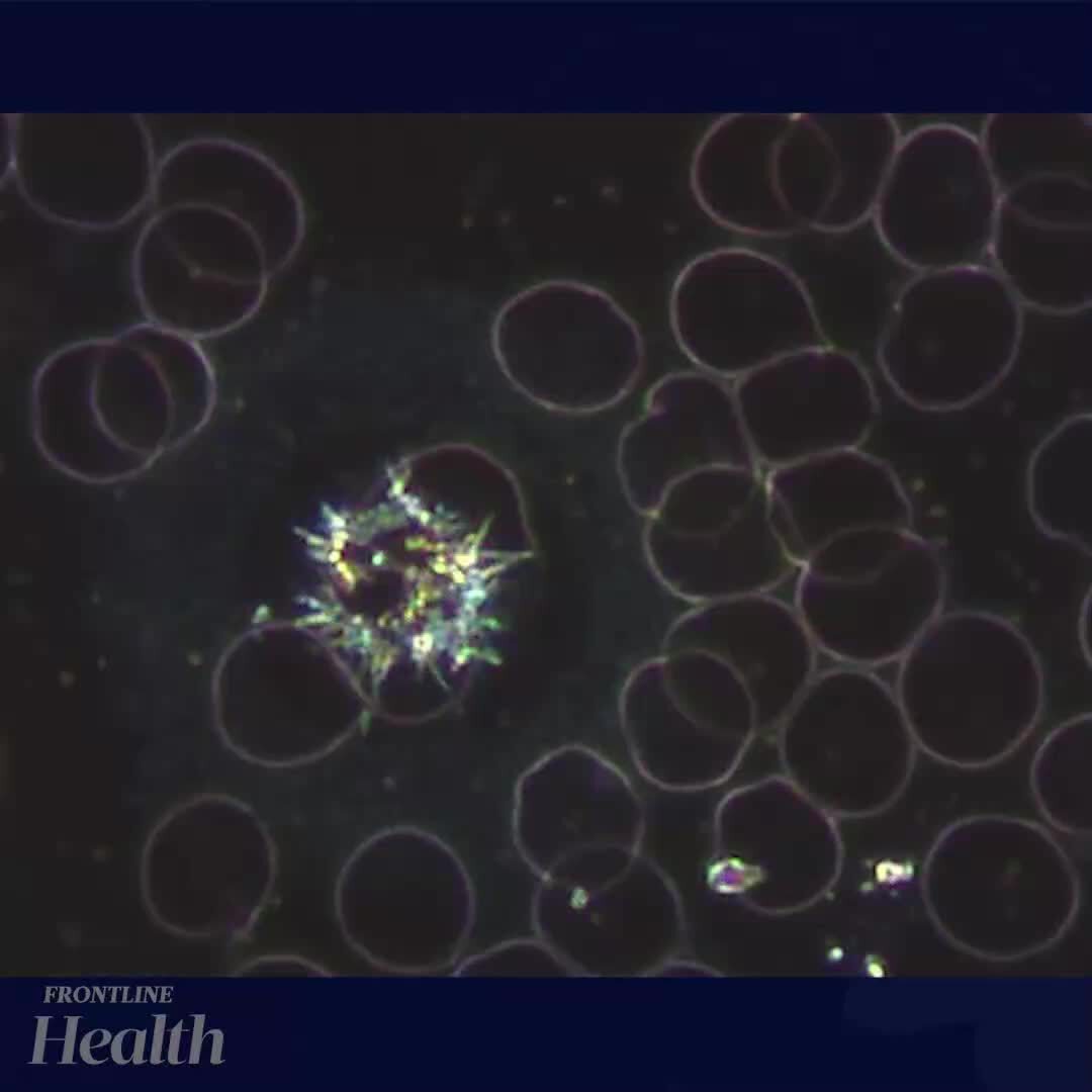 COVID-19 #vaccinated individuals can be identified by their blood sample alone, says a group of 60 i...