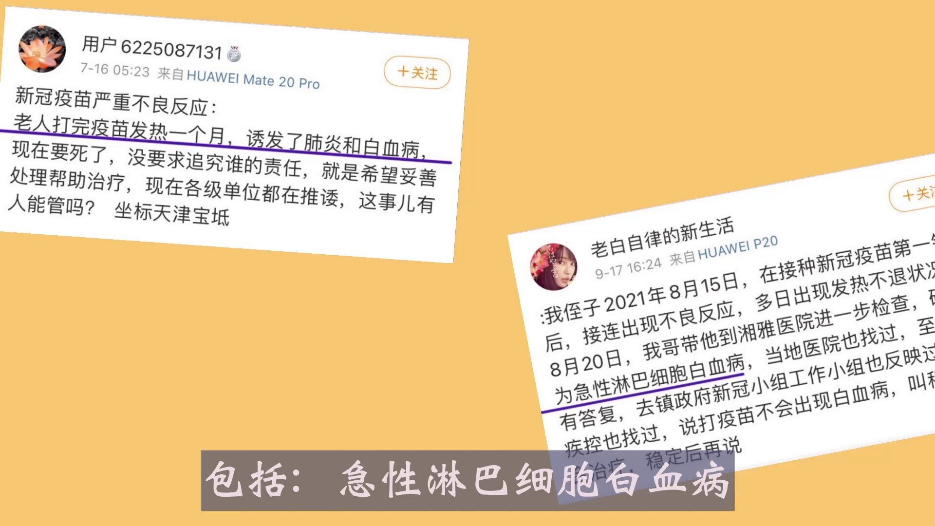 【新冠疫苗副作用实例分享6】
此视频主要分享：月经异常，白血病，面瘫，荨麻疹，心肌炎，癫痫
#新冠疫苗副作用 