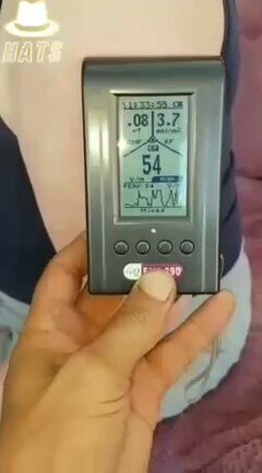 🚨💉
EMF(起電力)テストはワクチン接種が「送信機」になることを示しています。。