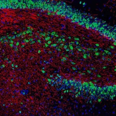 Sharing studies or articles of interest. Likes or shares don't equal endorsements. Studies shared are the intellectual p...