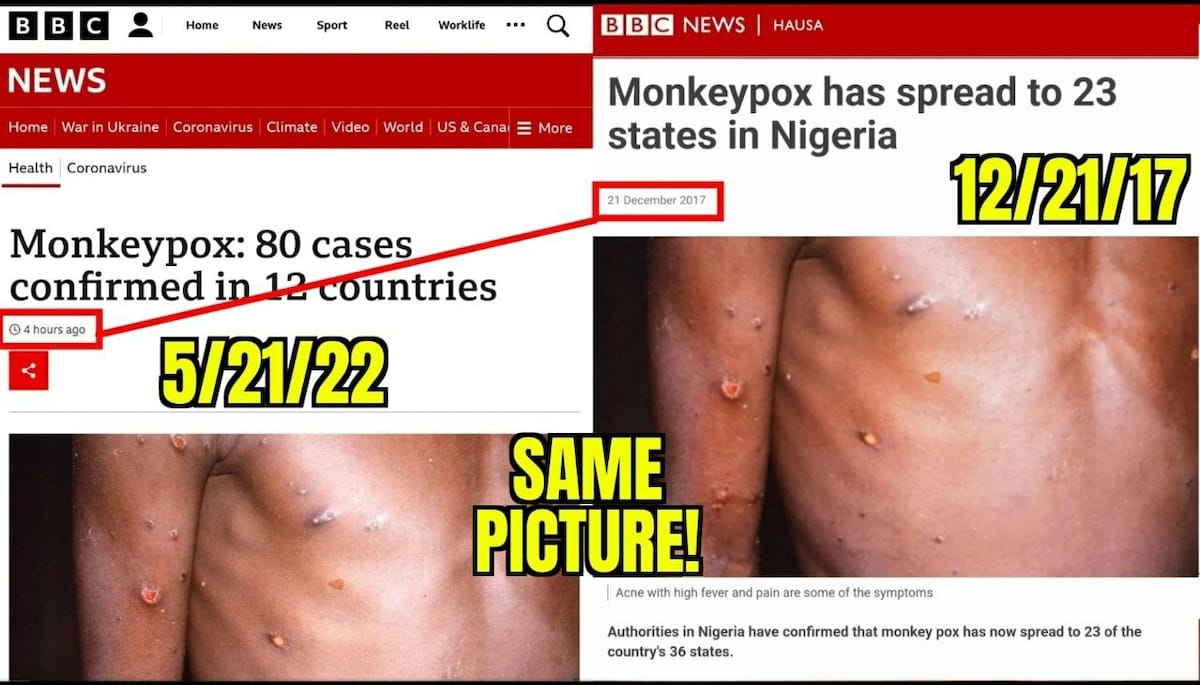 Exposing the Fake Monkey Pox.   Keep Sharing the Truth, Expose [them] all.  We are the News #TheBigM...