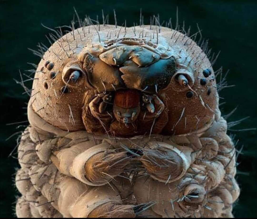 Ce truc adorable s’appelle un Demodex. il mesure à peu près 0,3 mm et est donc impossible à détecter...