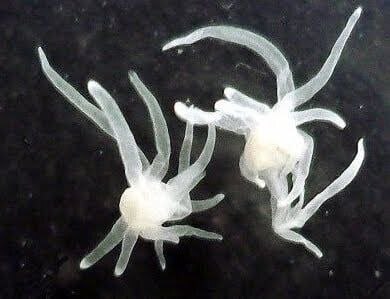 🚨💉😱
眼球に蠢く寄生虫の謎解明!?

マジェ博士が撮影したモデルナで発見された生物は、「ポリポディウム」として知られる寄生虫のようです。
この生物はチョウザメの卵（キャビア）に見られ、生殖器系...