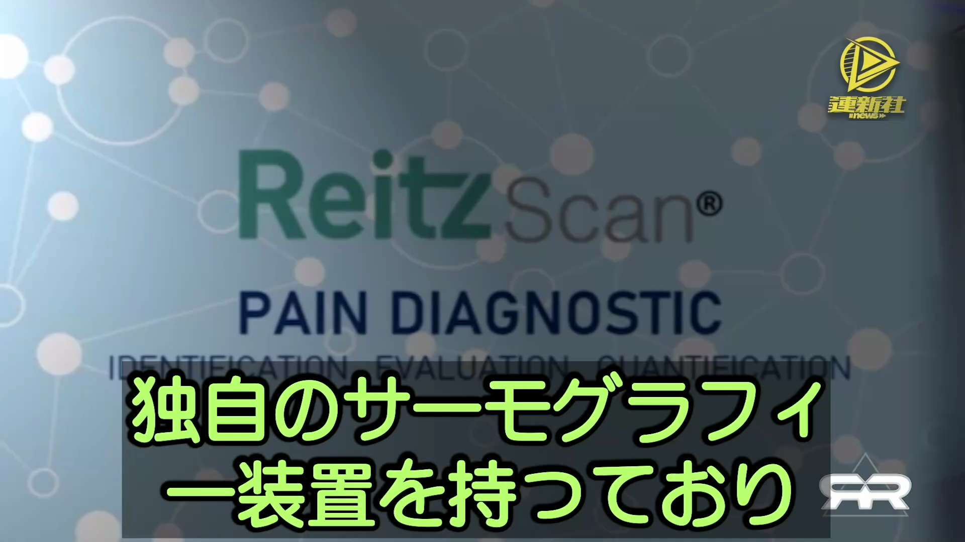 サーモグラフィーによると、無症状コロナワクチン接種者に大量の血栓があると確認された
サーモグラフィーによると、コロナワクチンを接種した無症状の患者の血管系に大量の血栓があることが示されている。健康な血液サンプルにコロナワクチンを加えると、顕微鏡の下で血液が凝集して血栓が形成され始めるのが確認された
#コロナワクチン #無症状接種者 #サーモグラフィー #血栓症