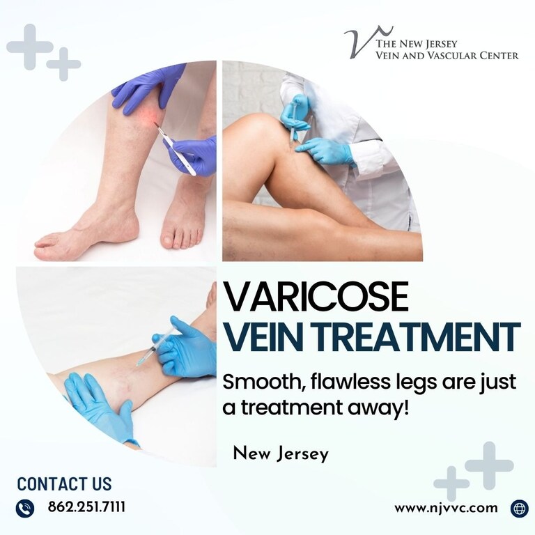 Varicose veins can cause discomfort and affect your quality of life. If you're seeking effective varicose vein treatment, finding the right doctor is cruci