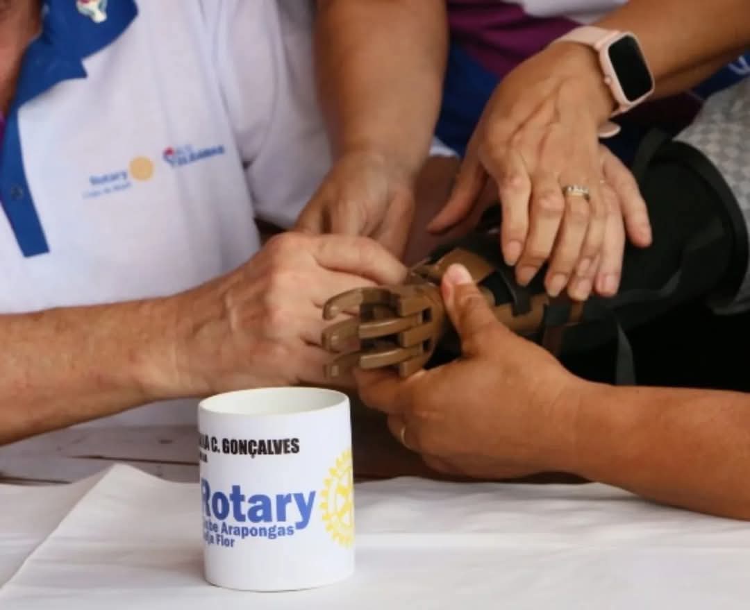 CLUBES DE ROTARY ENTREGARÃO GRATUITAMENTE 36 MÃOS MECÂNICAS A AMPUTADOS DOS ESTADOS DE ALAGOAS, BAHI...