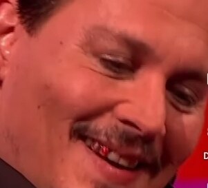 What is that on his tooth?