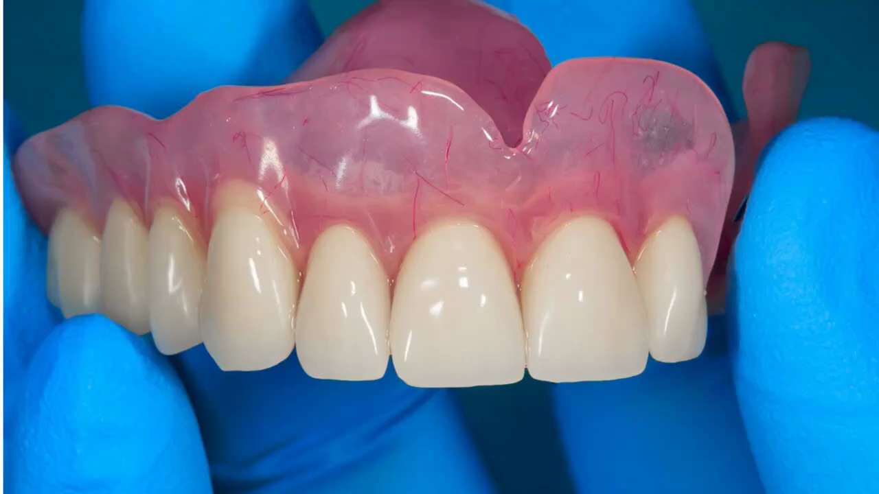 At Florida Dental Care of Miller, we understand how important a healthy smile is. Our expert team sp...