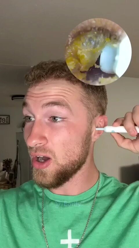 smart ear cleaner
https://technoant.co/products/ear-cleaner?ref=easybuy

