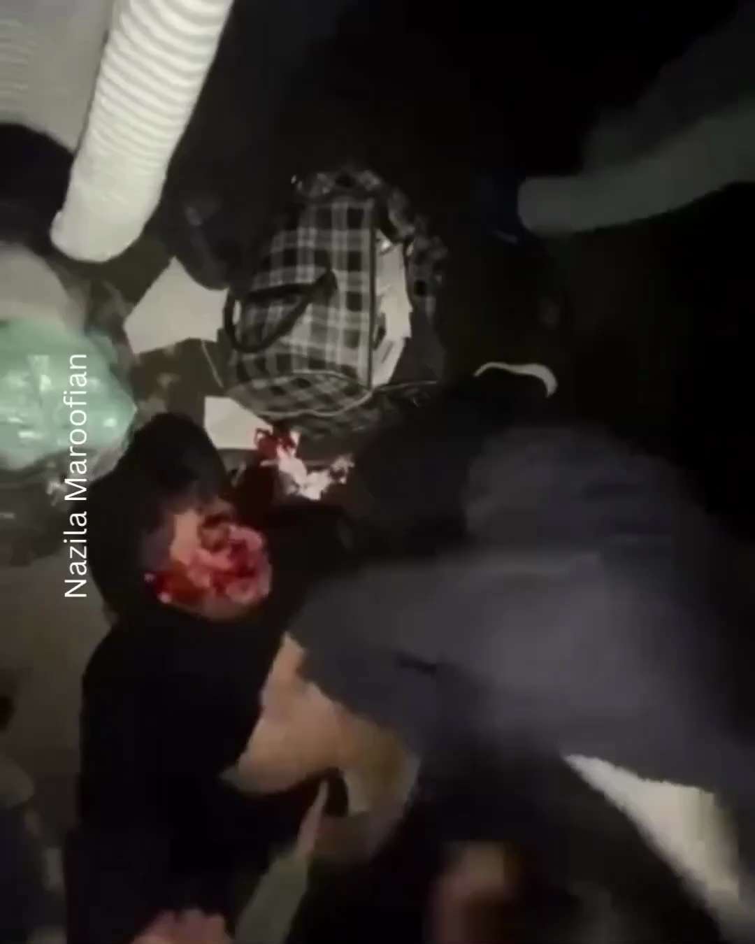 ⚠️Warning graphic images⚠️

Khamenei's terror regime killing revolutionaries with live rounds.