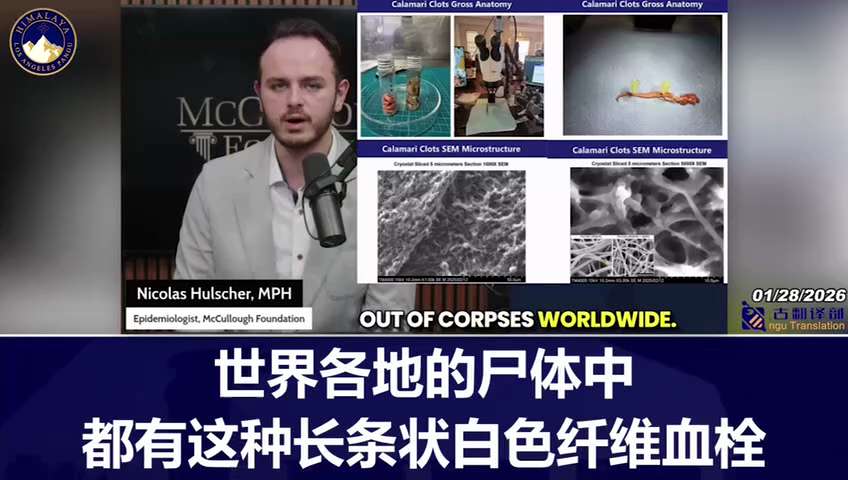 A new peer-reviewed study has found prion-like amyloid microthrombi in 100% of COVID-19 vaccine reci...