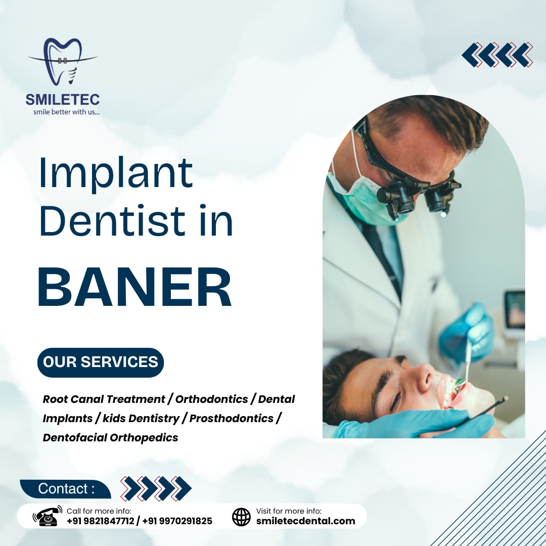 https://smiletecdental.com/implant-dentist-in-baner/
