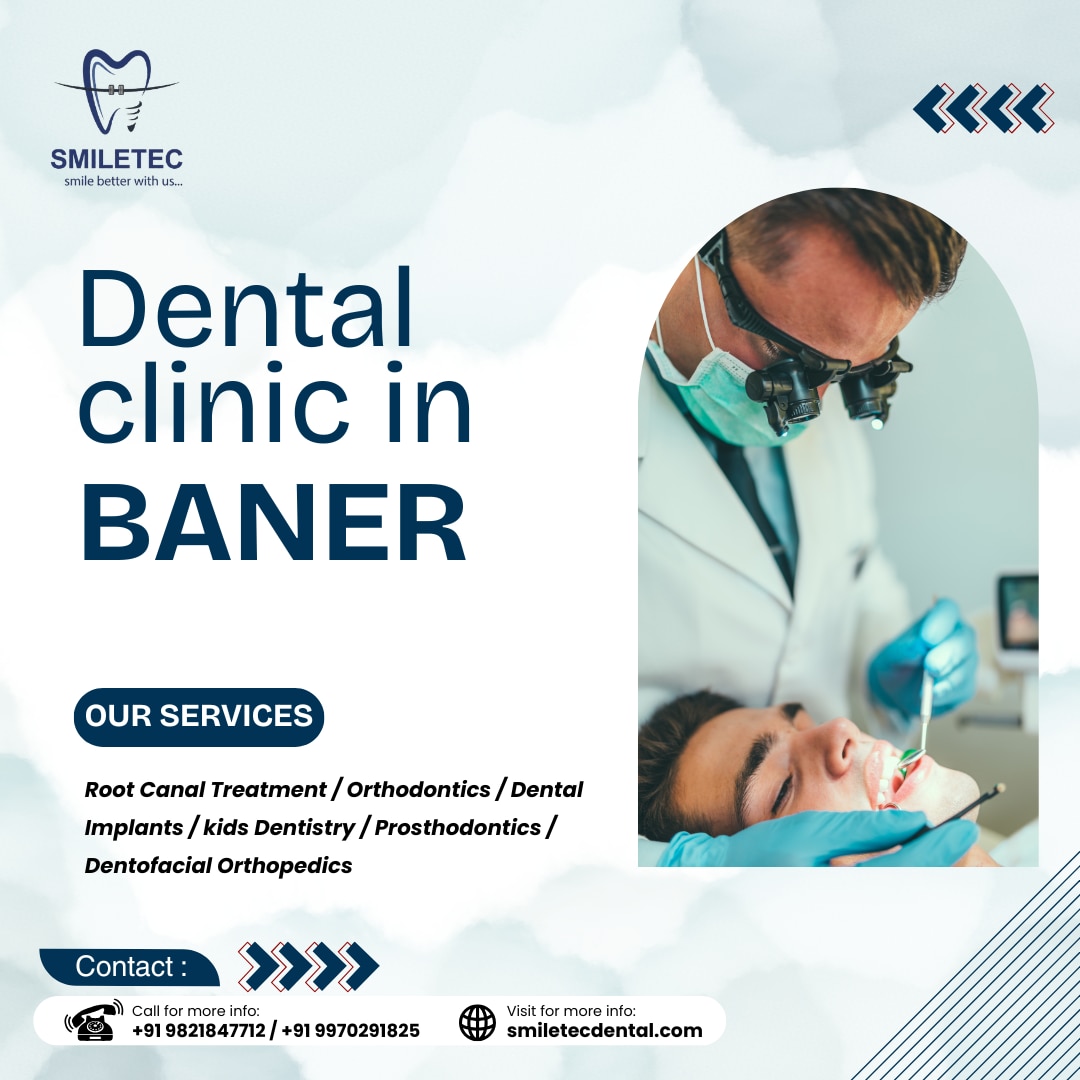 https://smiletecdental.com/dental-clinic-in-baner-pashan-link-road/
