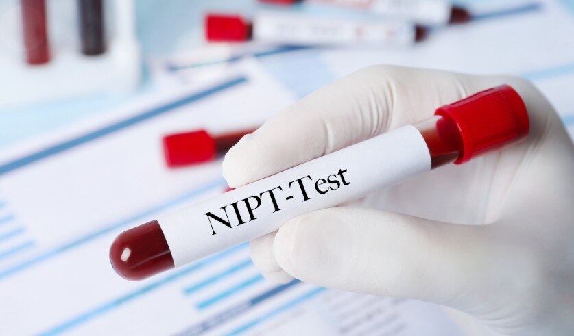 Xét nghiệm NIPT là xét nghiệm gì? Có thay thế được chọc ối không?
Sàng lọc và chẩn đoán trước sinh l...
