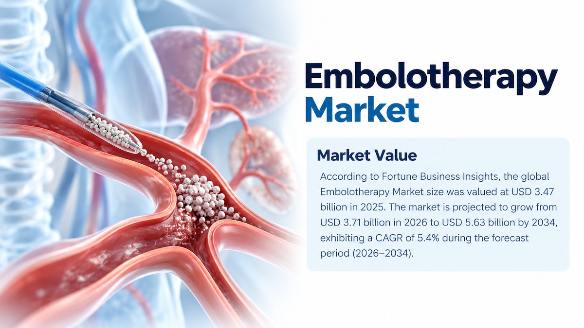 Embolotherapy Market Size, Share, Growth Trends, Industry Analysis, and Forecast 2026–2034

Accordin...