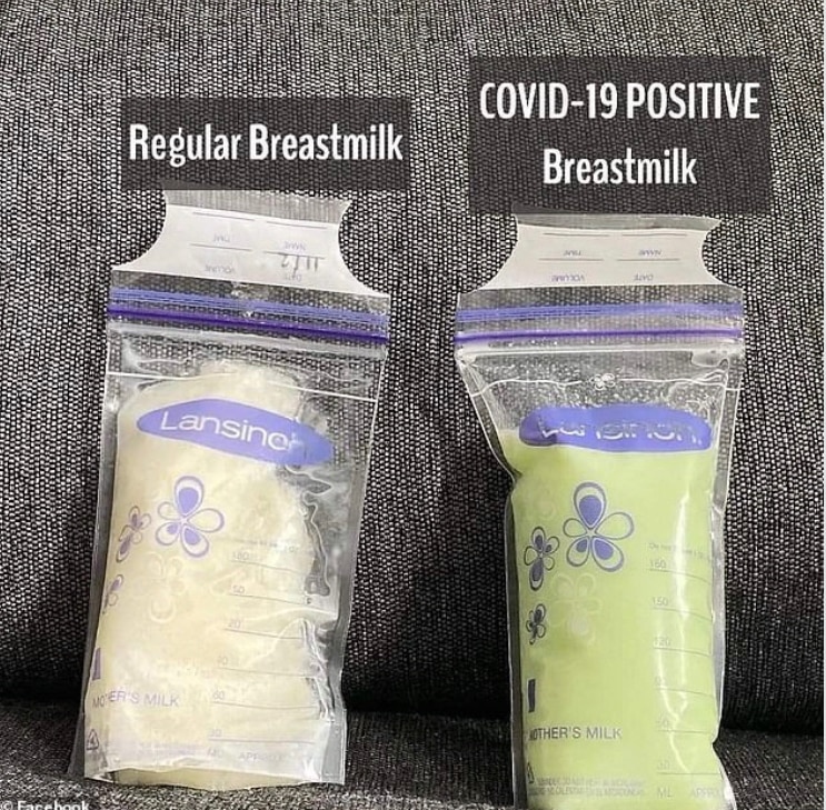 NEWS IN THE WORLD OF STUPID TODAY IS:-

Double vaxed Mothers breast milk turns GREEN then she tests ...