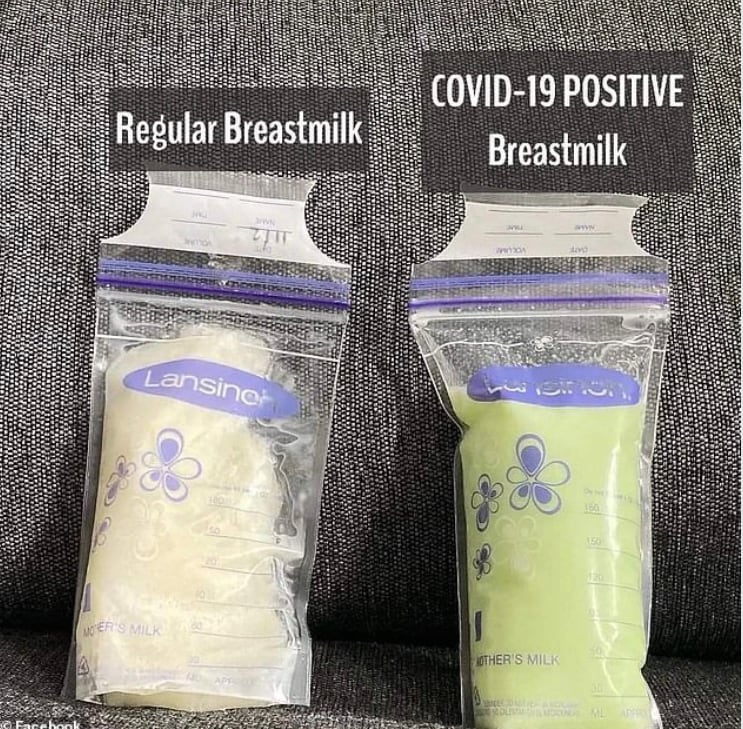 NEWS IN THE WORLD OF STUPID TODAY IS:-

Double vaxed Mothers breast milk turns GREEN then she tests ...