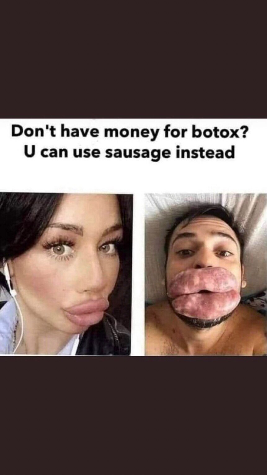 No more Botox for me