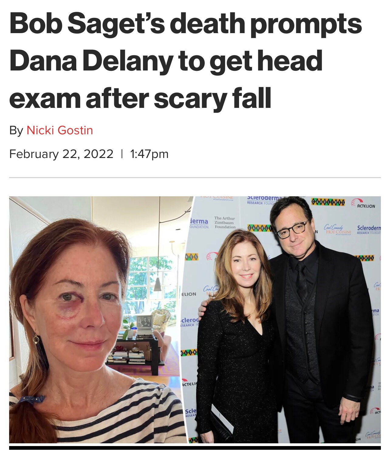 “Dana Delany says the recent death of her pal Bob Saget prompted her to seek medical care after she tumbled down a staircase.

“I fell down some iron stairs head first (totally sober!) & all I could think of was poor Bob Saget,” she recalled. “So I grabbed the handrail with my face. I was afraid it was fractured but thankfully, no.”

https://pagesix.com/2022/02/22/bob-sagets-death-prompts-dana-delany-to-get-head-exam-after-a-fall/ 