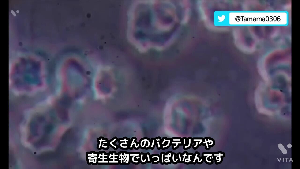 ［〜12秒］ コロナワクチンを接種していない人の血液  ［13秒〜1:09］ 接種者の血液、血栓の原因 （網はフィブリンのことじゃないかな？と思います）  ［1:10〜2:12］ 接種者の血液がバクテリアや寄生生物だらけになっている様子  故モンタニエ博士も言っていました、3回接種者はHIV検査をすべきと…