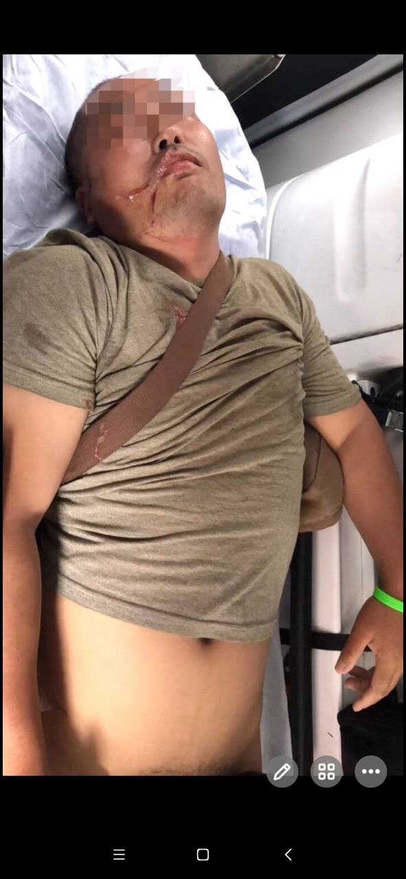 公然殴打储户……