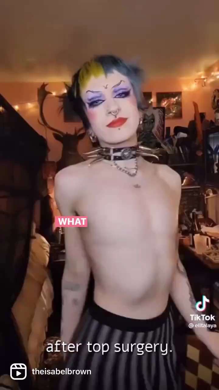 Literally where did all the “free the nipple” pro-breasts feminists go?! Asking for a friend 🙃