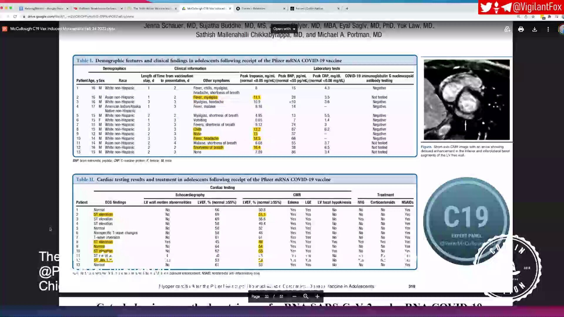 Dr. McCullough Provides an Explanation as to Why Athletes Are Collapsing on the Pitch

"When you hav...