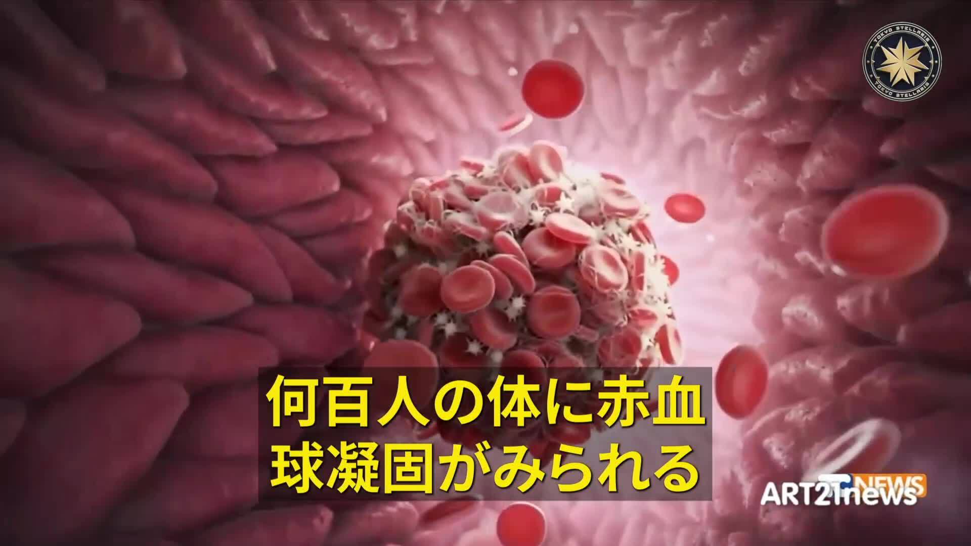 ジョバンニーニ医学博士は「 80%ワクチン接種者の体が構造的な変化」

「血小板凝集、グラフェンの痕跡、そしてワクチンの最初の投与からの恐ろしい臨床症状。
ワクチン接種者の 80% に体の構造変化があ...