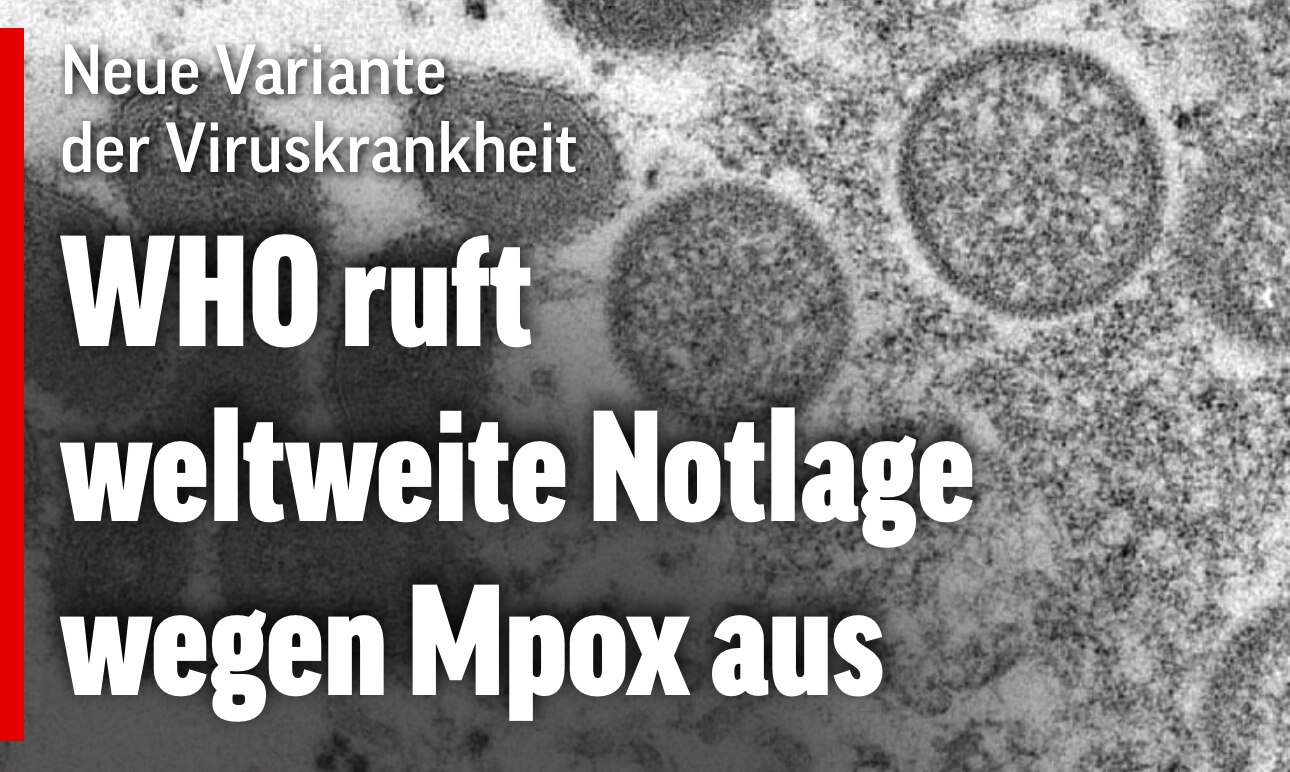 🇨🇭Neue Pandemie: Affenpocken!

👉🏻 Nur die Souveränitäts-Initiative kann unsere Grundrechte besch...