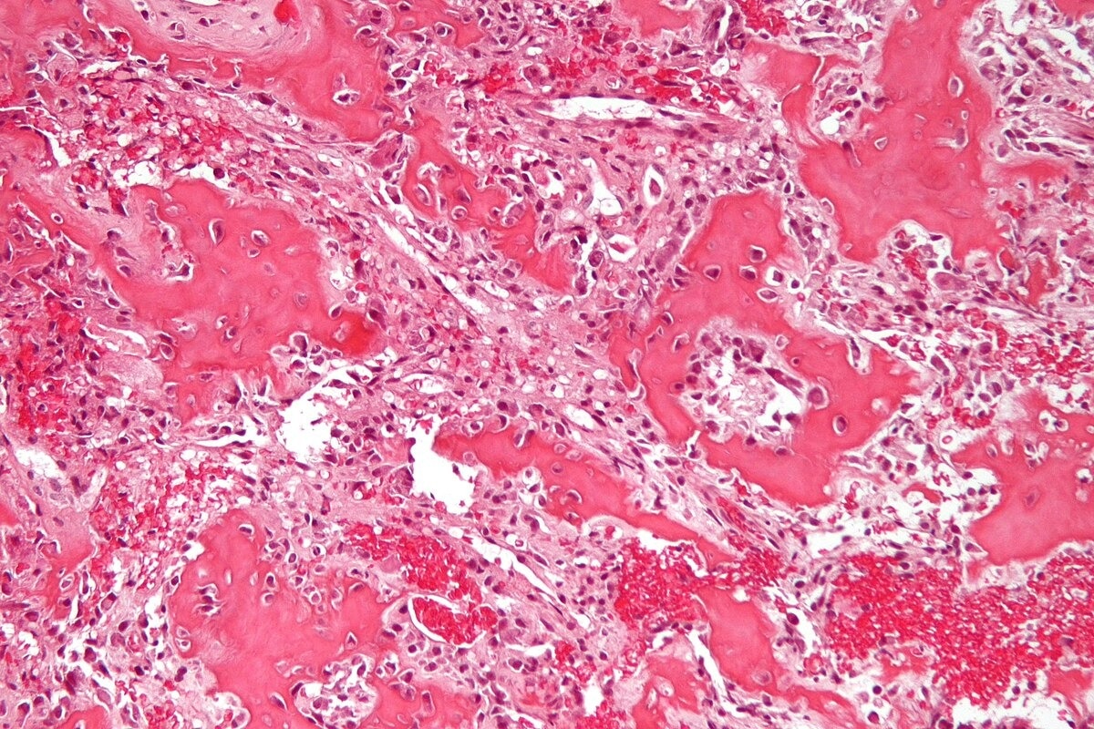 Human Osteoblasts Market is Estimated to Witness High Growth Owing to Advancements in Regenerative M...