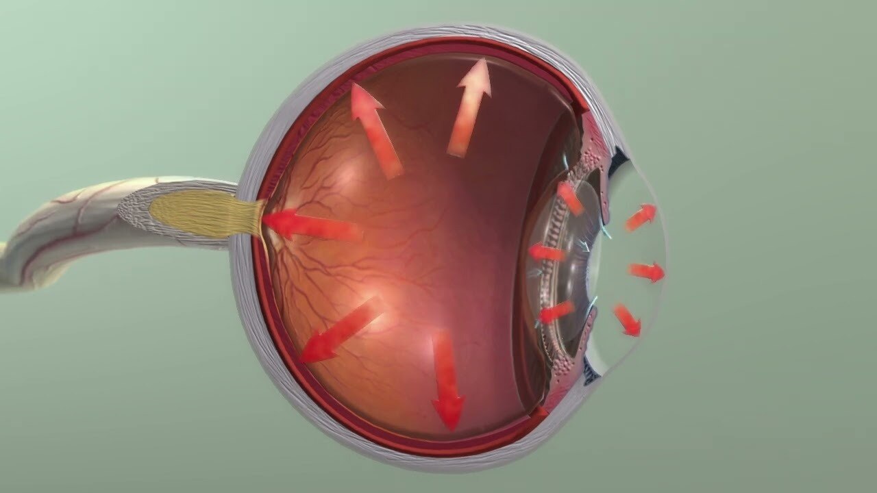 Open-Angle Glaucoma Drugs Market to Surge with Rho Kinase Inhibitors

 The Open-Angle Glaucoma Drugs...
