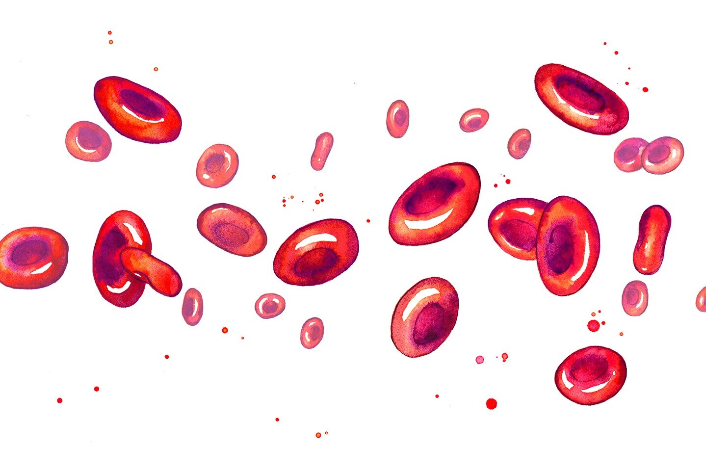 Warm Autoimmune Hemolytic Anemia Market to Grow with Monoclonal Antibody Therapies


 Warm autoimmun...